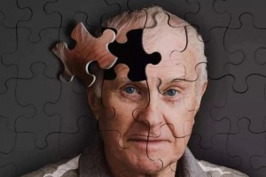这5类人患阿尔兹海默症风险高，要注意提前预防